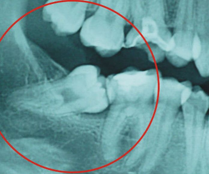 Radiografias: Servicios de Clínica Dental Flordent }}