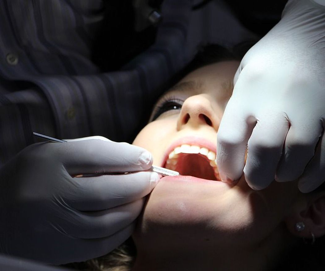 Beneficios de la limpieza dental