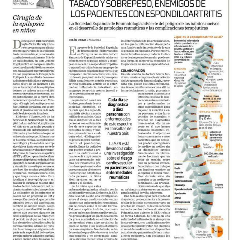 Artículo periódico Tribuna: Cirugía de la epilepsia en niños: Especialidades y publicaciones de Doctor Villarejo