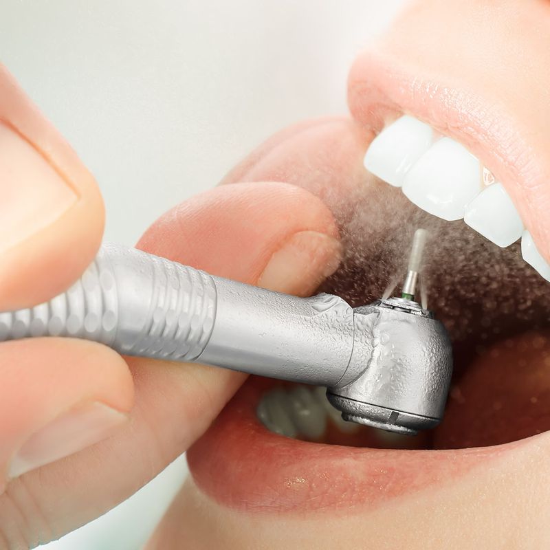 Periodoncia: Tratamientos de Clínica Dental Liliana Rinaldi