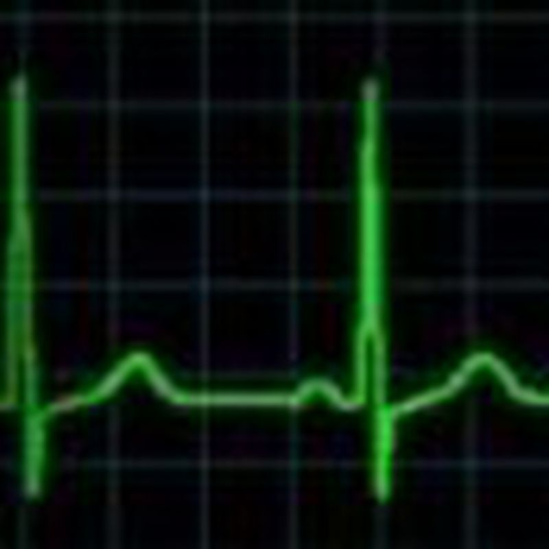 Electrocardiograma: Productos y servicios de Veterinario El Puertito