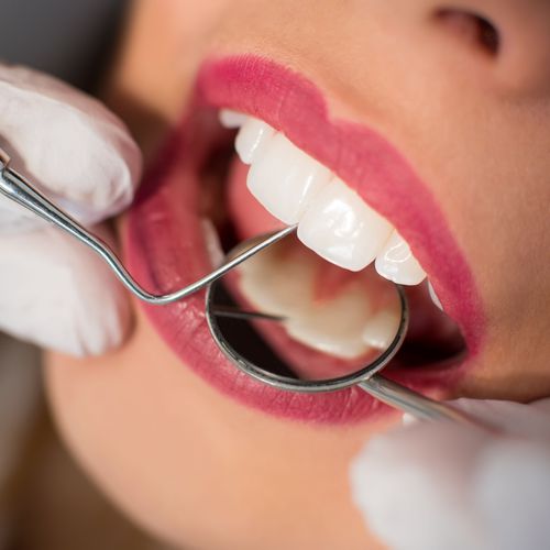 Implantes dentales en Oroso