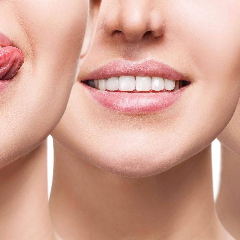 Estética dental: Tratamientos de Clínica Dental Liliana Rinaldi